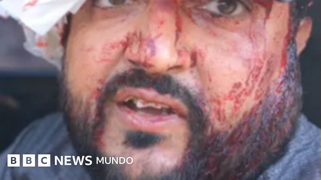 Colonos israelíes agreden a palestinos y a periodista estadounidense en Cisjordania